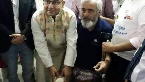 মুজিব শতবর্ষ উদযাপন: ওসমানী হাসপাতালে বিনামূল্যে কৃত্রিম পা সংযোজন