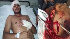 সিলেটে সশস্ত্র সন্ত্রাসী হামলায় স্বেচ্ছাসেবক দলনেতা গুরুতর আহত